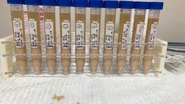 10 frozen yeast tubes ready for use in the future! Making a Frozen Yeast Stock Bank