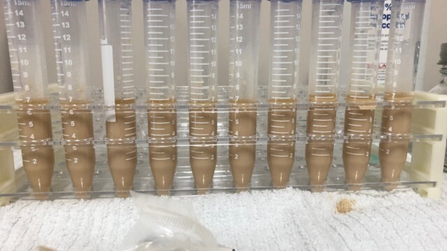 Tubes with yeast in each Making a Frozen Yeast Stock Bank