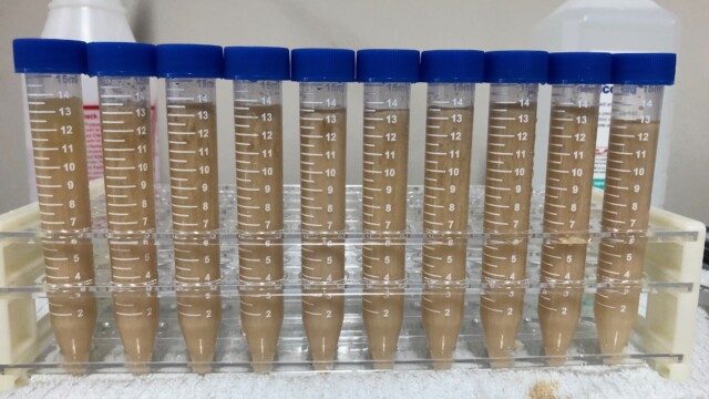 Tubes with yeast and glycerin-based cryopreservative Making a Frozen Yeast Stock Bank